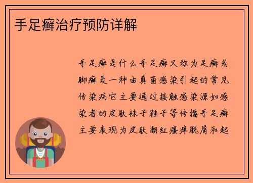 手足癣治疗预防详解